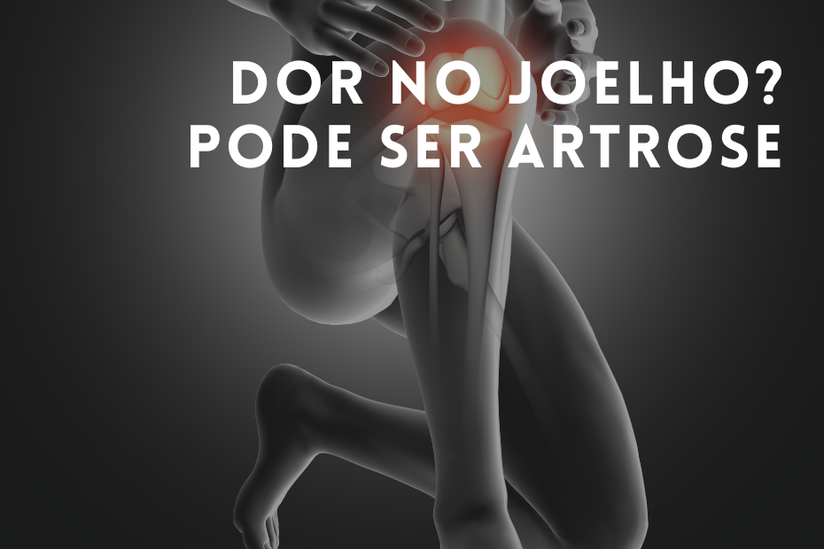 Dor no joelho Pode ser artrose Rádio Aki1 Digital