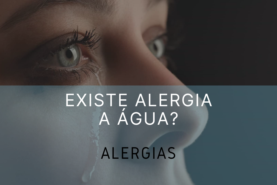 Existe alergia à água?