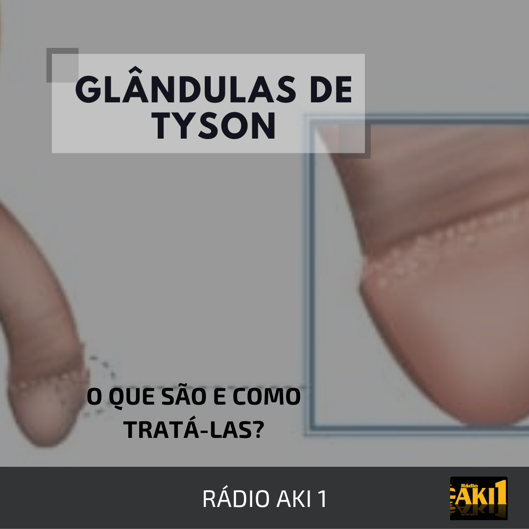 Glândulas de Tyson: O que são e como tratá-las? - Rádio Aki1 Saúde