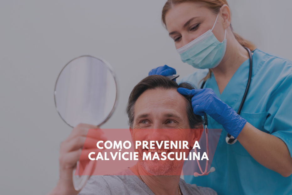 Como Prevenir a Calvície Masculina: Dicas Essenciais