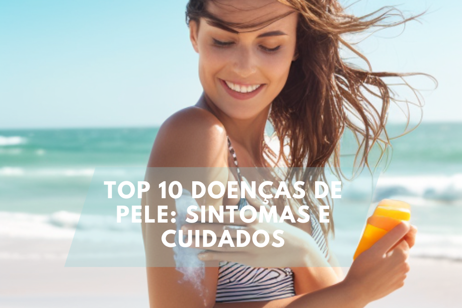 Top 10 Doenças de Pele: Sintomas e Cuidados