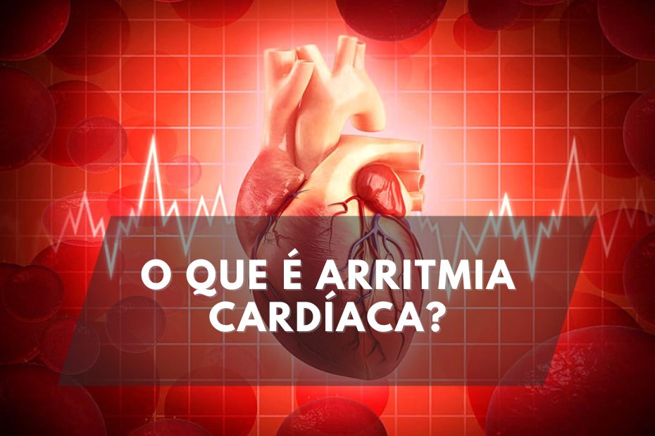 O que é Arritmia Cardíaca?