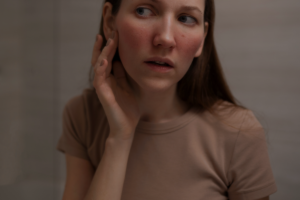 Quais são as causas da vermelhidão na pele