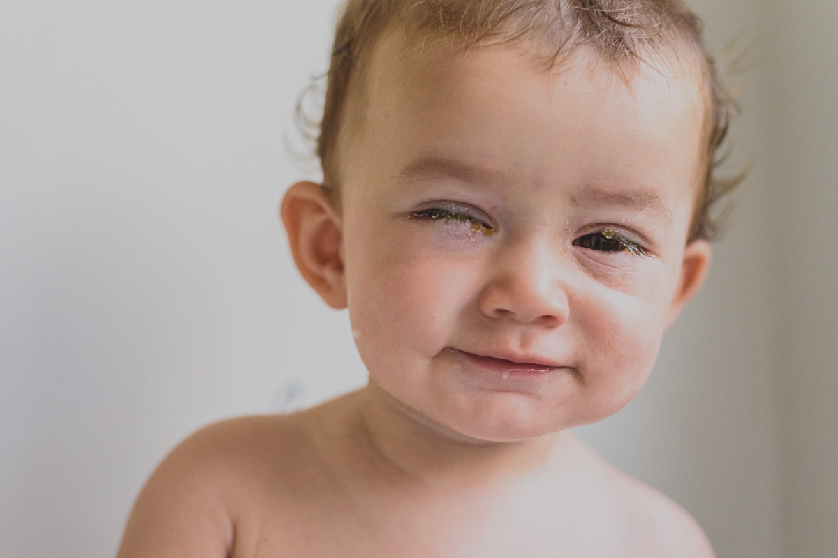 Olhos remelando no bebê: o que pode ser (e o que fazer)