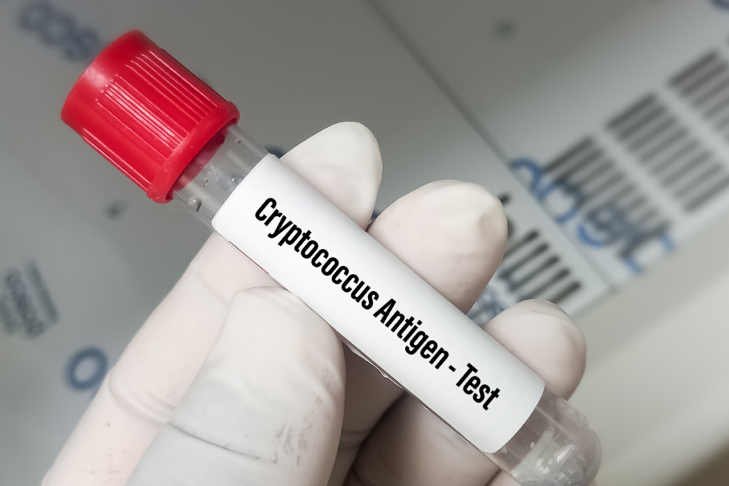 O que é a Criptococose?