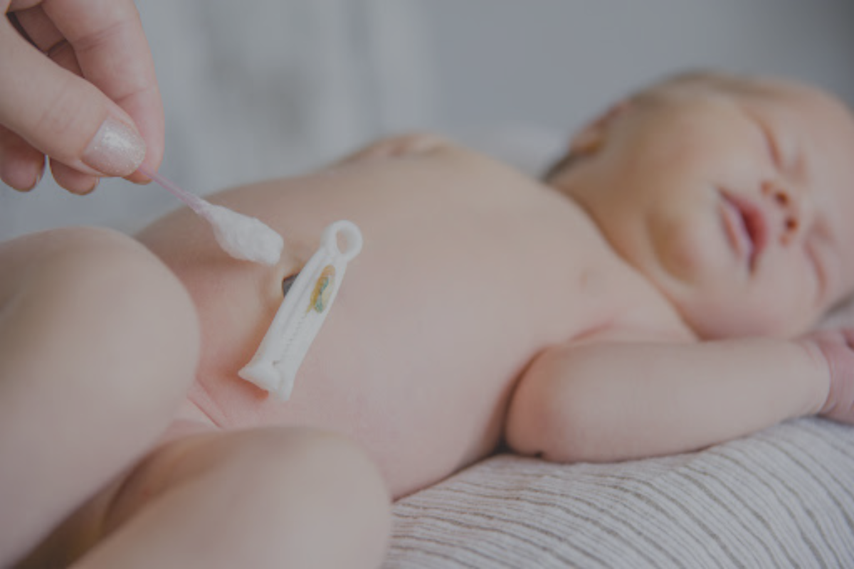 Coto Umbilical: O Que É, Cuidados e Como é Feita a Limpeza